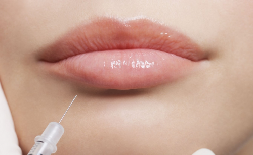 Labios